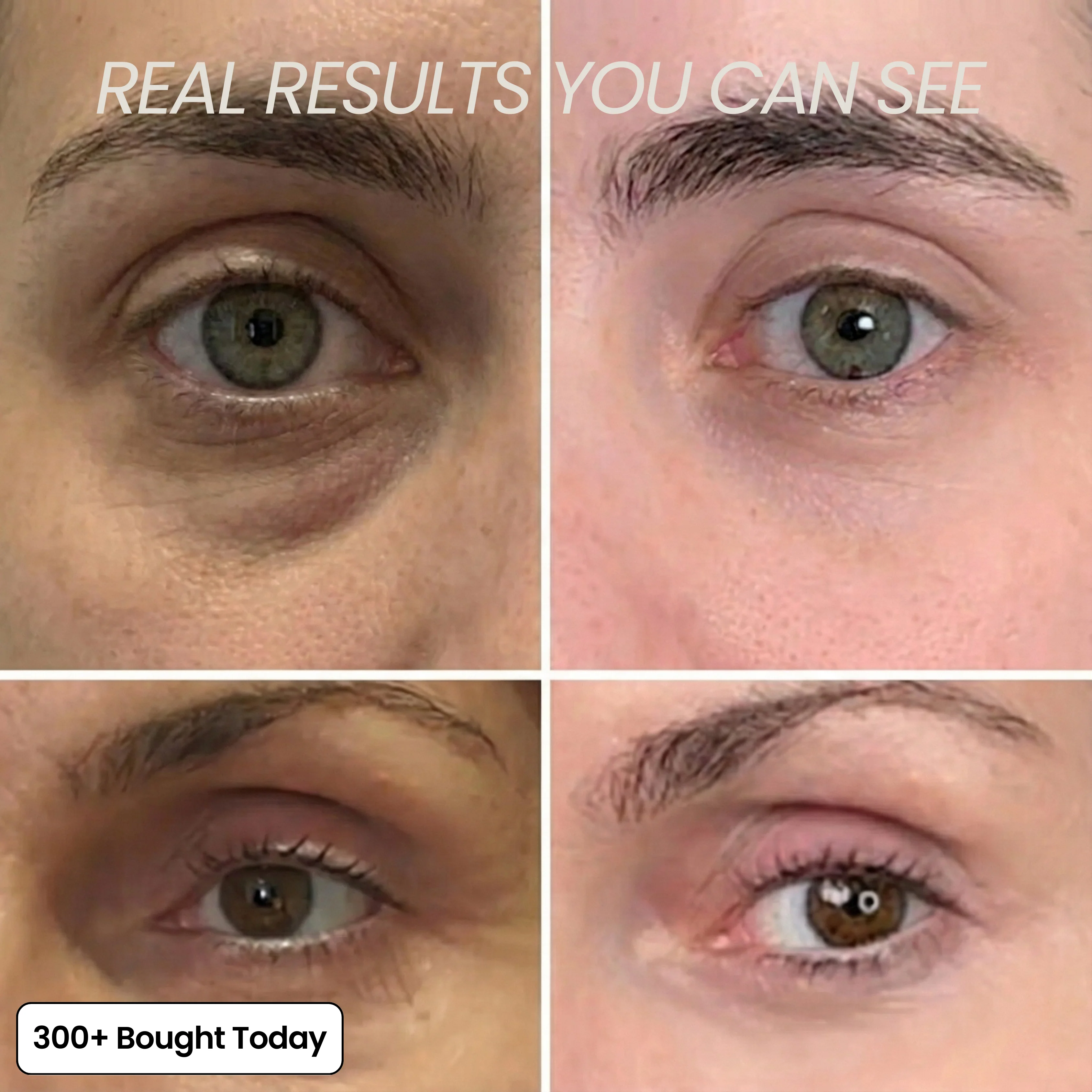 COMPLETE FACE RENEWAL KIT - Image 10