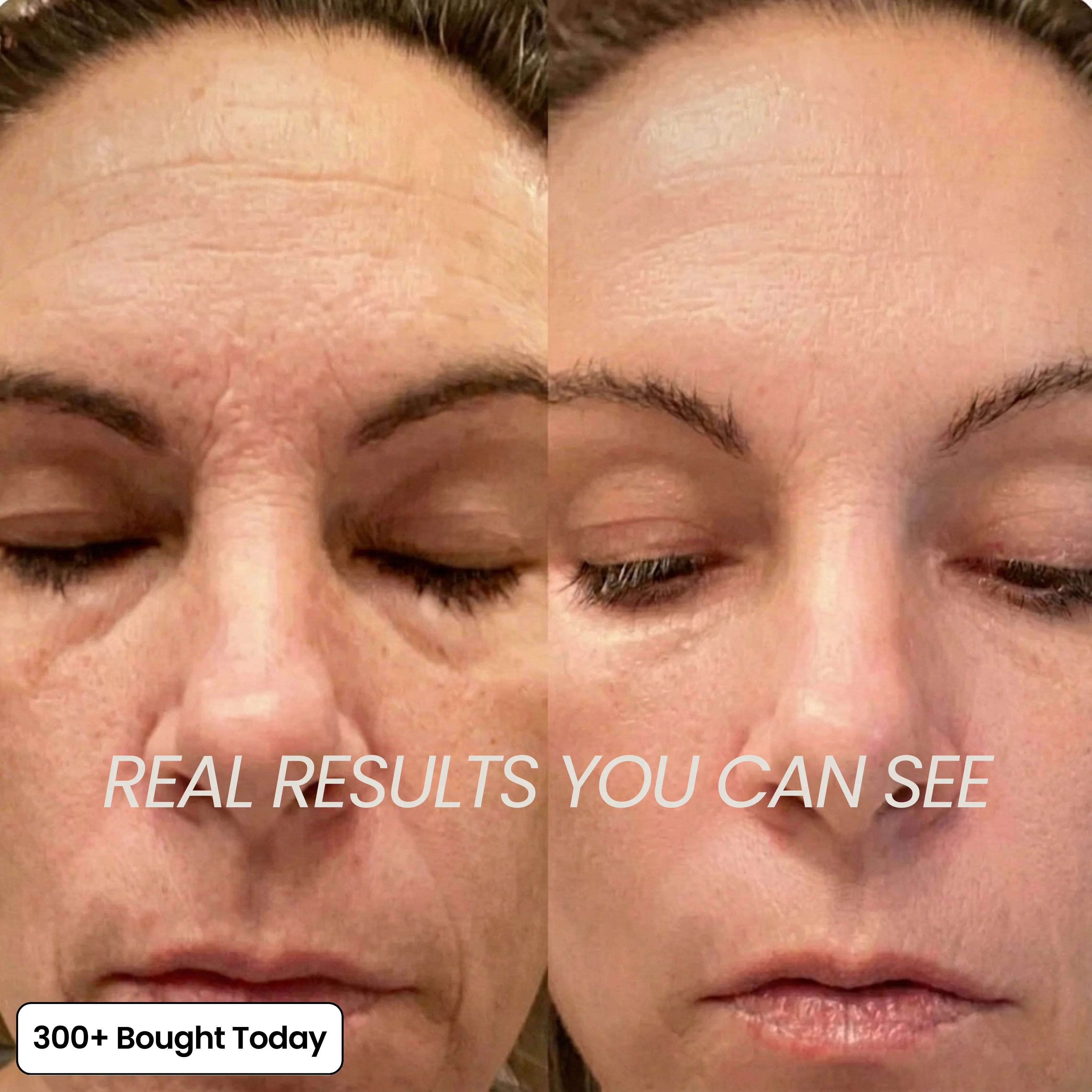 COMPLETE FACE RENEWAL KIT - Image 7
