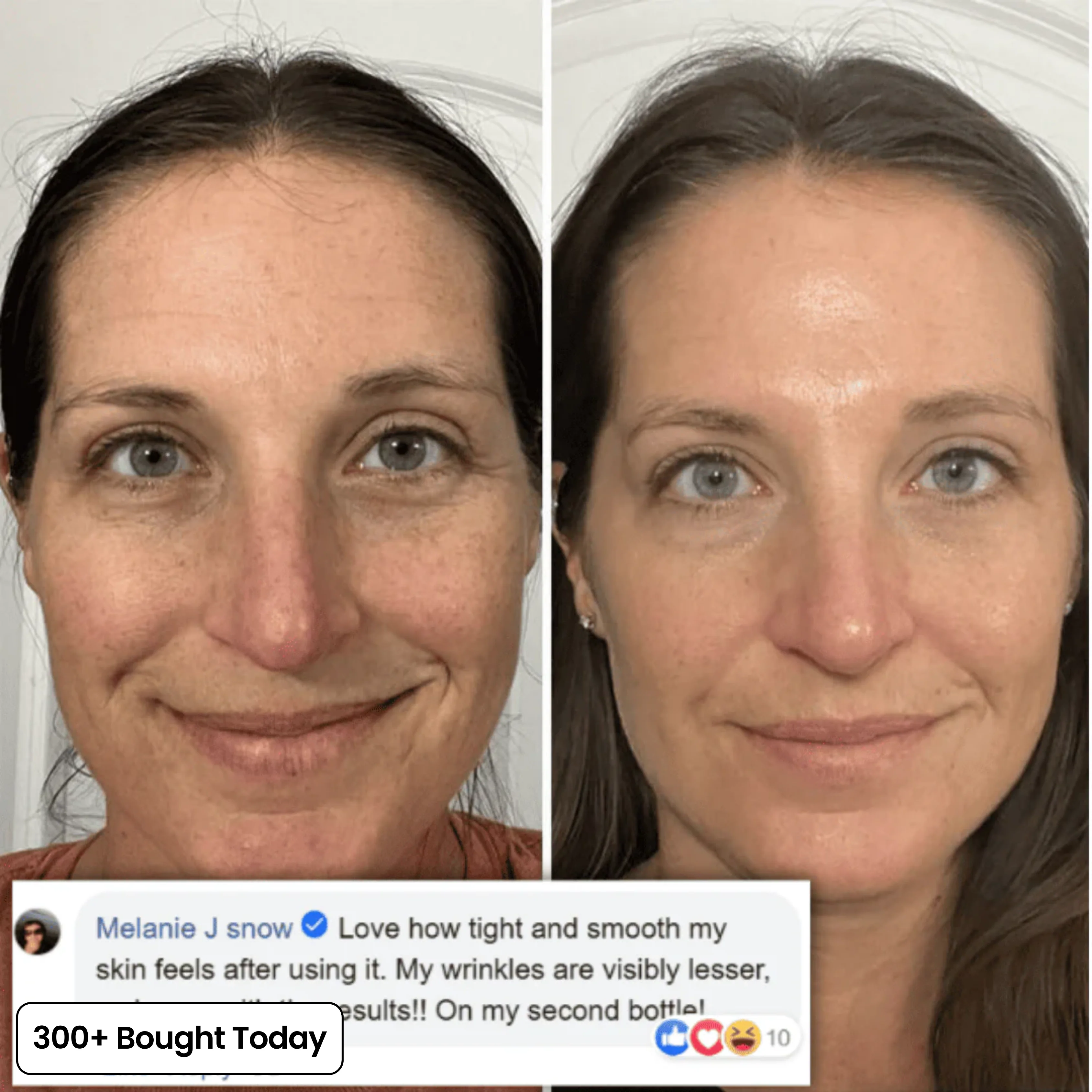 COMPLETE FACE RENEWAL KIT - Image 8