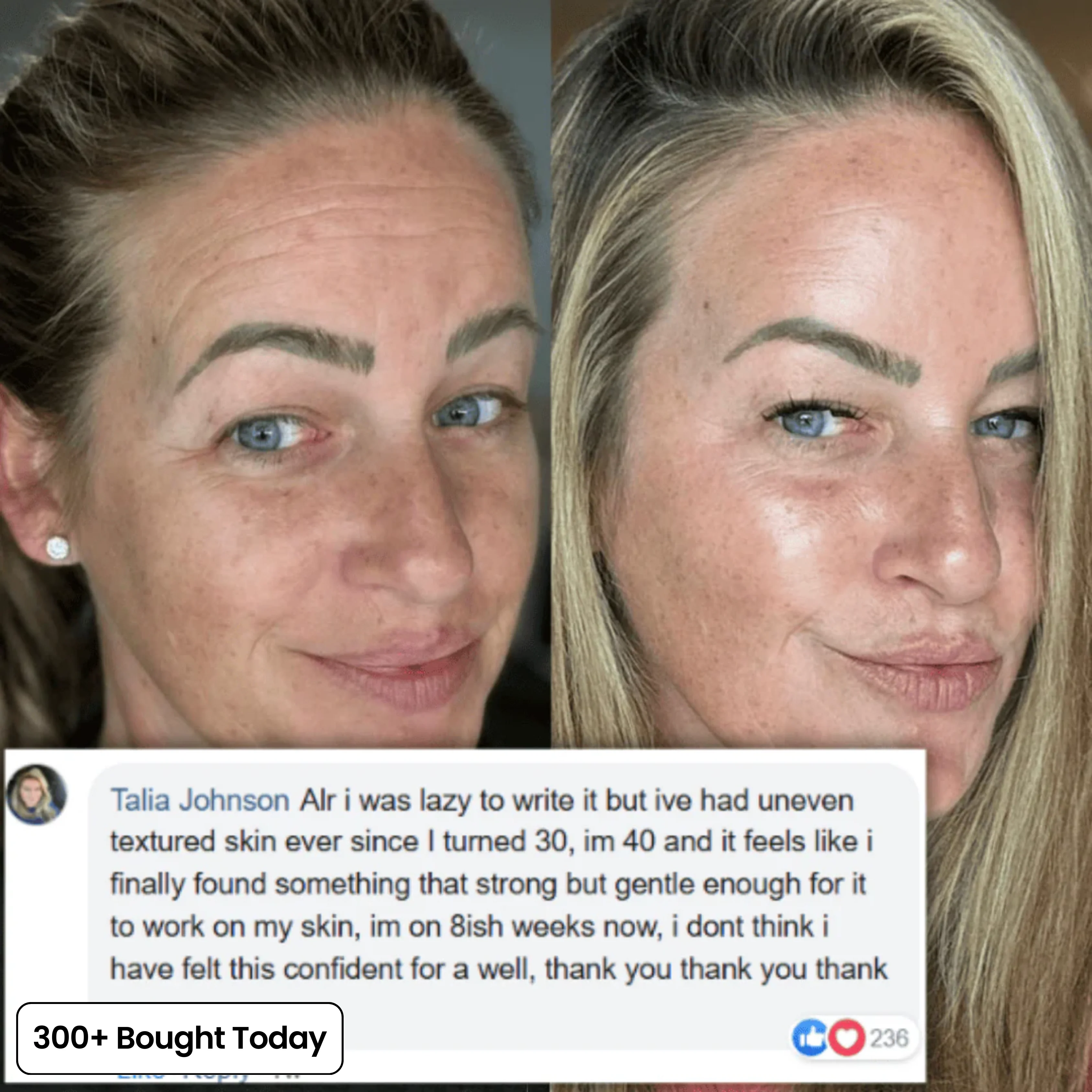 COMPLETE FACE RENEWAL KIT - Image 9