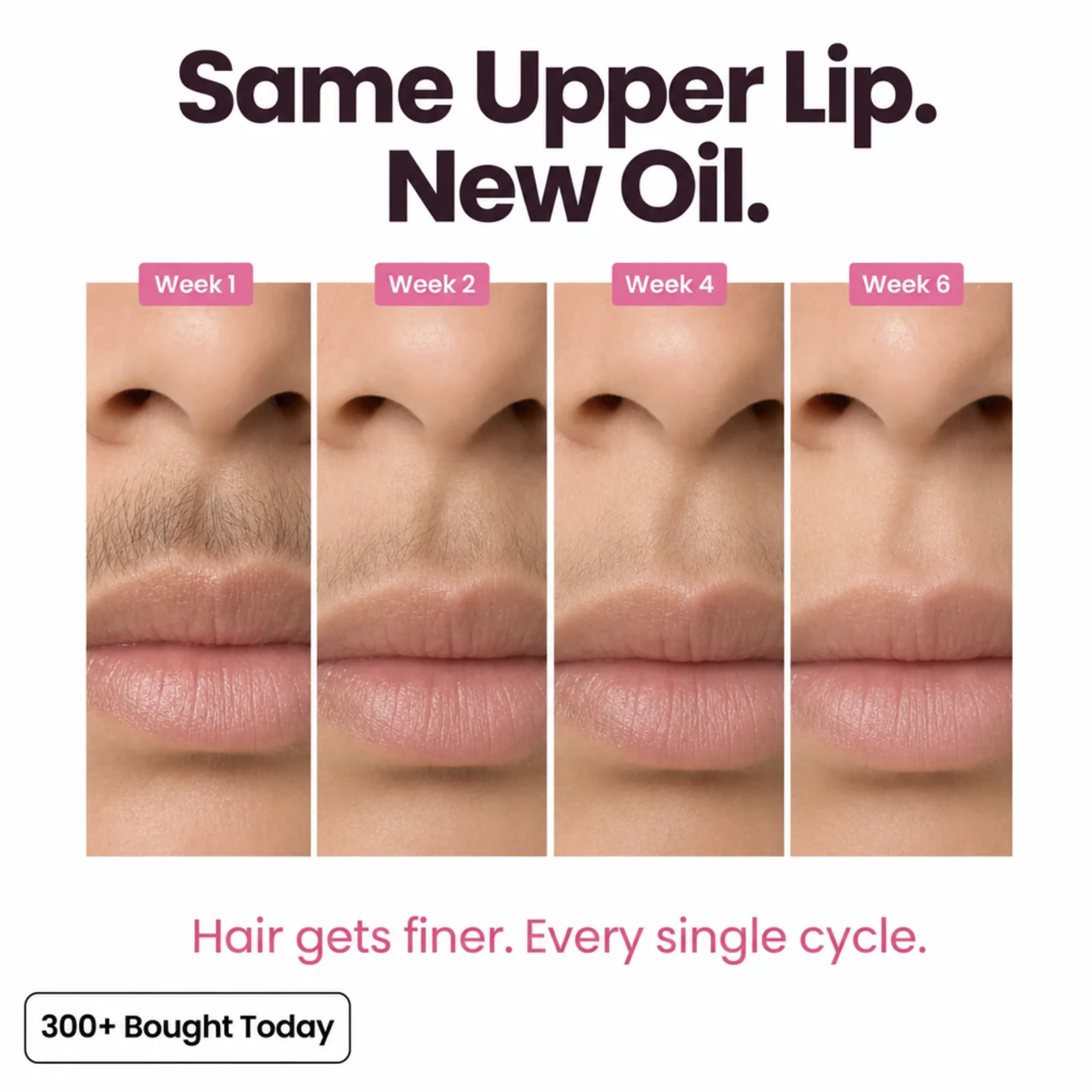 Stop Your Bikini Line, Legs, Chin & Upper Lip Hair from Growing Back, Naturally - Image 3