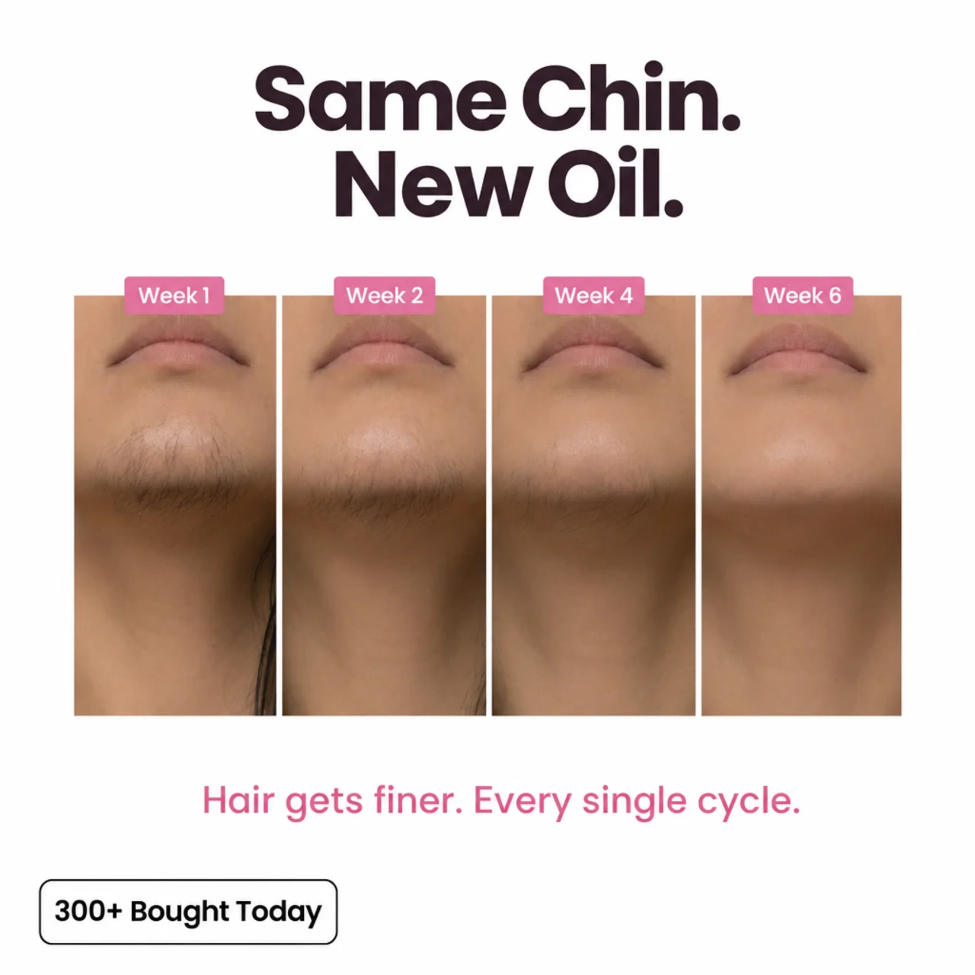 Stop Your Bikini Line, Legs, Chin & Upper Lip Hair from Growing Back, Naturally - Image 4