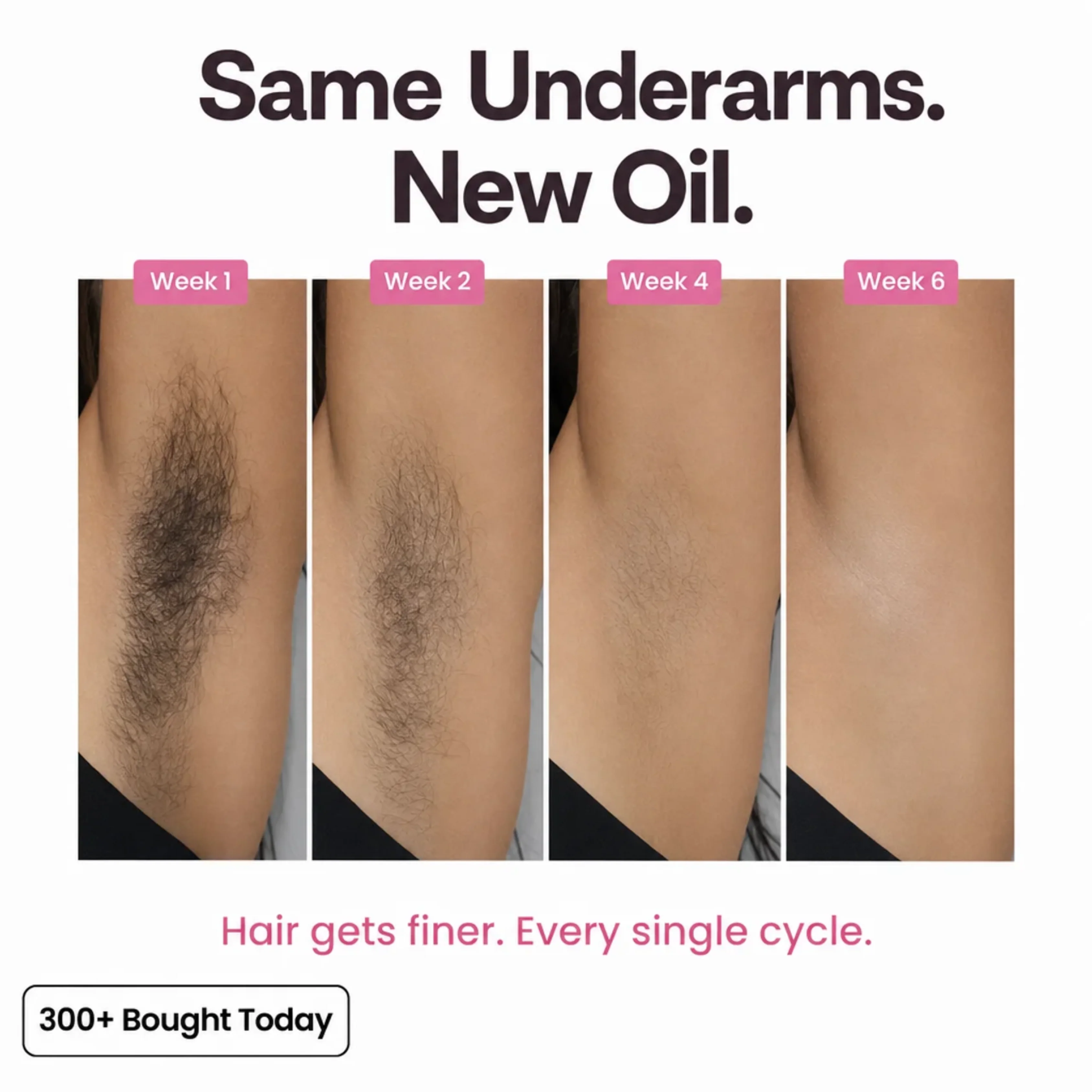 Stop Your Bikini Line, Legs, Chin & Upper Lip Hair from Growing Back, Naturally - Image 5