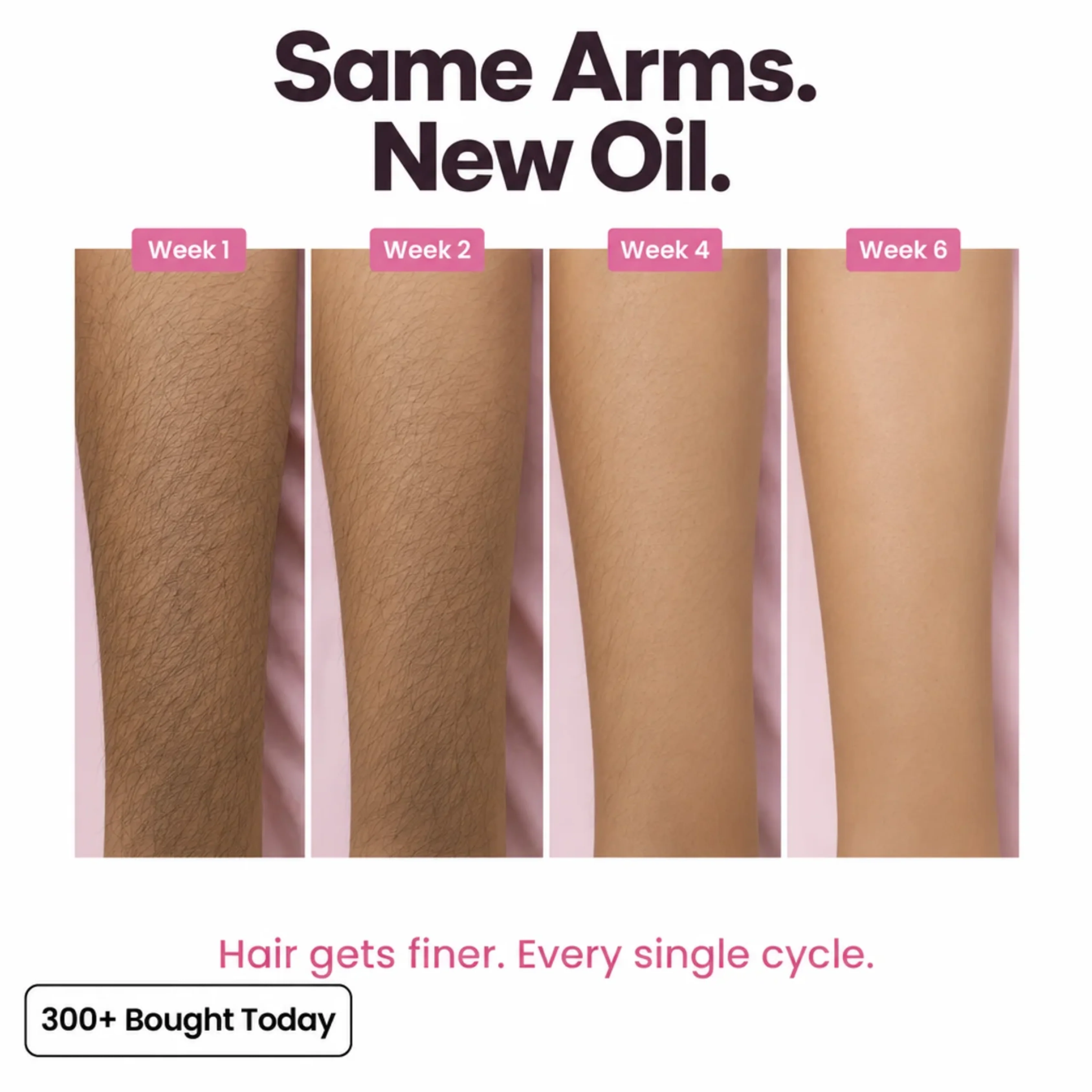 Stop Your Bikini Line, Legs, Chin & Upper Lip Hair from Growing Back, Naturally - Image 6