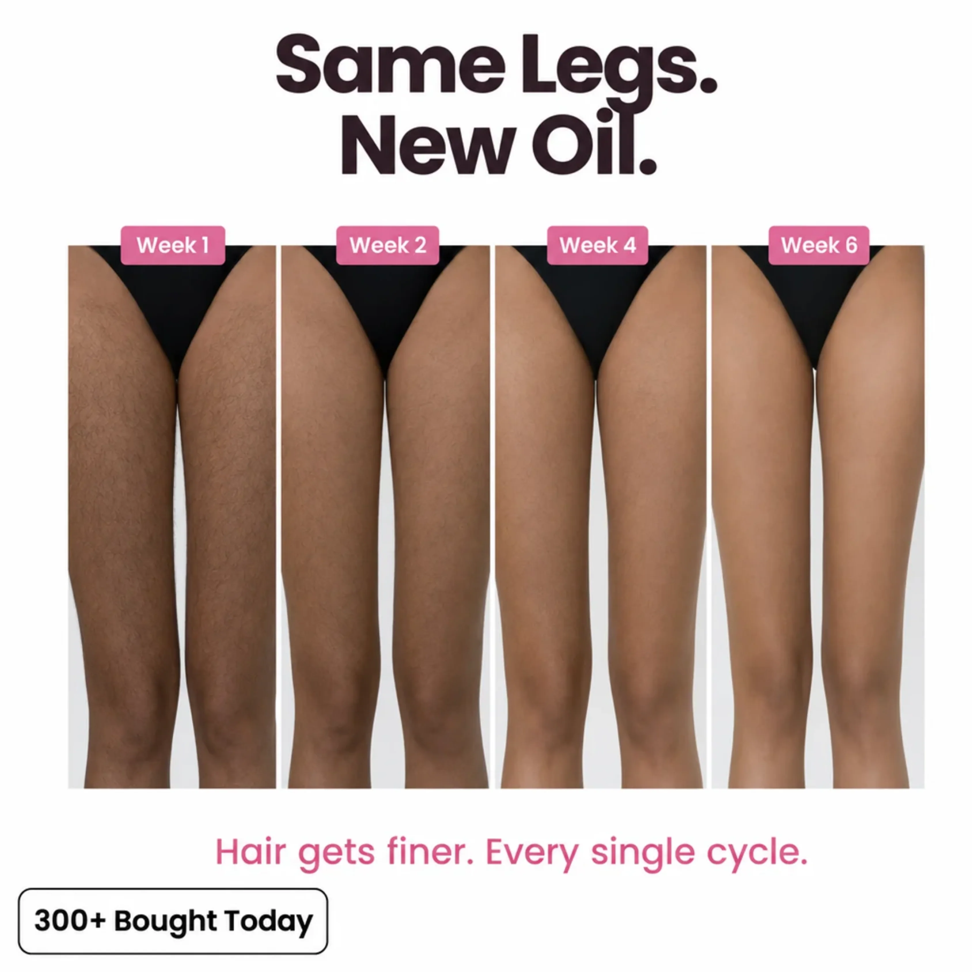 Stop Your Bikini Line, Legs, Chin & Upper Lip Hair from Growing Back, Naturally - Image 7